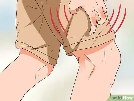 Image titled Tell Signs of Sexual Infection from Penis Step 13