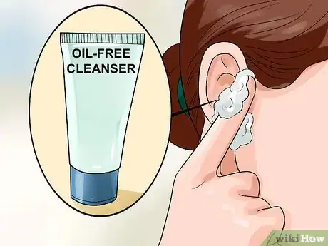 Image titled Get Rid of Pimples Inside the Ear Step 4