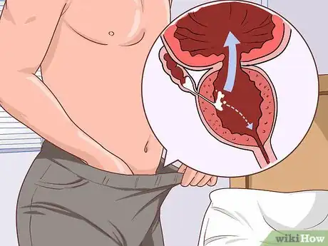 Image titled Treat Testicular Cancer Step 14