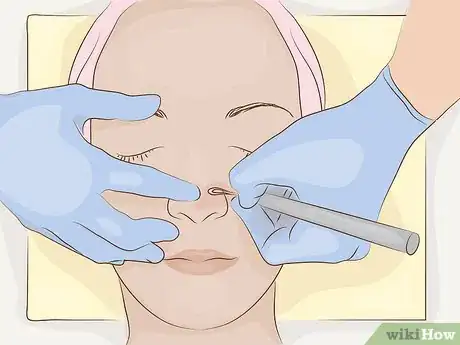 Image titled Reduce Pore Size on Your Nose Step 16