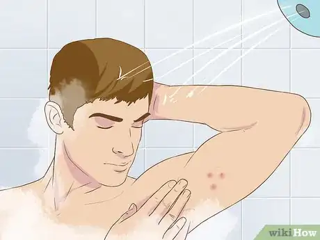 Image titled Get Rid of a Zit on Your Armpit Step 1