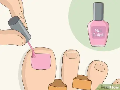 Image titled Give Yourself a Pedicure Using Salon Techniques Step 17