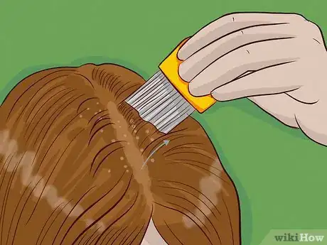 Image titled Get Rid of Lice Step 7