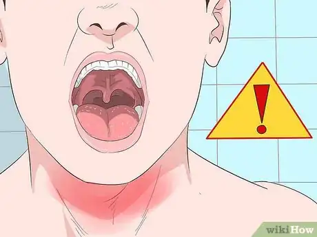 Image titled Get Rid of a Sore Throat Quickly Step 21