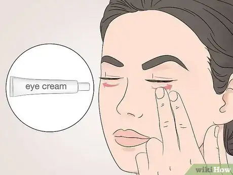 Image titled Stop Eyelids from Getting Oily Step 2