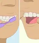 Whiten Teeth