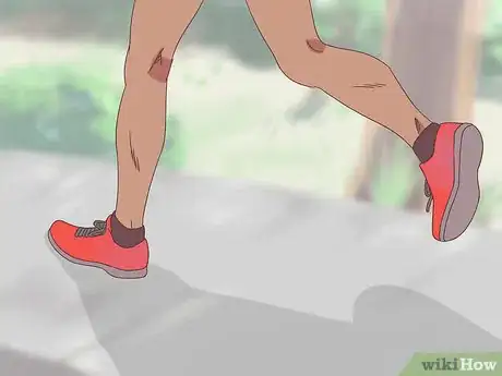 Image titled Prepare for a Cross Country Race Step 2