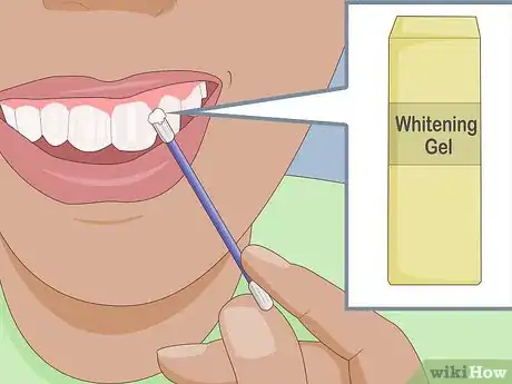 Image titled Protect Gums During Teeth Whitening Step 7