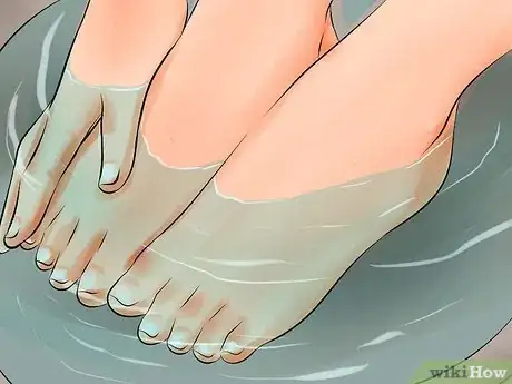 Image titled Remove an Ingrown Toenail Step 1