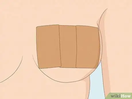 Image titled Tape Your Boobs for a Strapless Dress Step 3