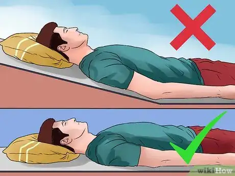 Image titled Treat Costochondritis Step 10