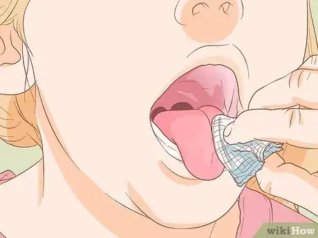 Image titled Stop Tongue Bleeding Step 5