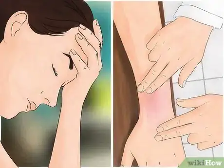 Image titled Get Rid of Bug Bites Step 15