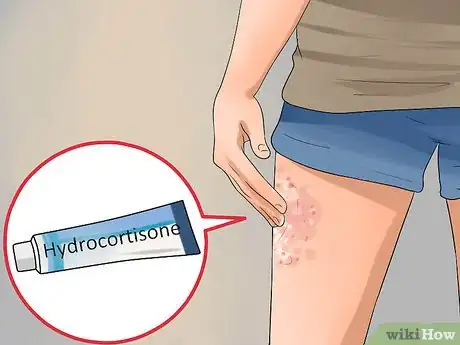 Image titled Treat Contact Dermatitis Step 7