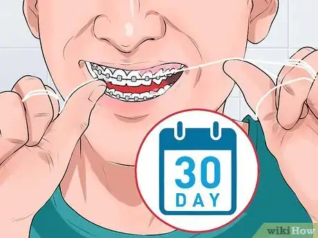 Image titled Make Braces Look Less Noticeable Step 10