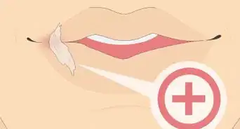 Remove Super Glue from Your Skin (Petroleum Jelly Method)