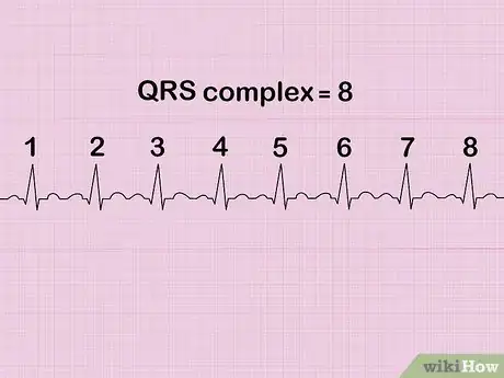 Image titled Calculate Heart Rate from ECG Step 6