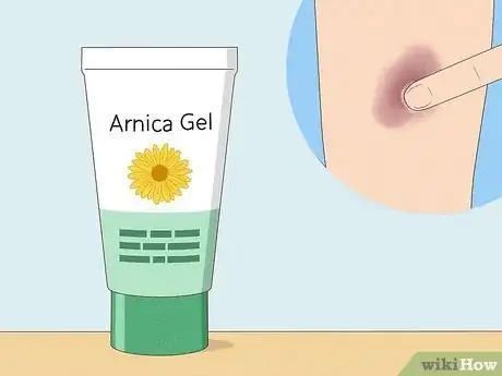 Image titled Get Rid of Bruises with Toothpaste Step 13