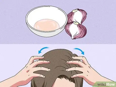 Image titled Increase Blood Circulation in Your Scalp Step 7