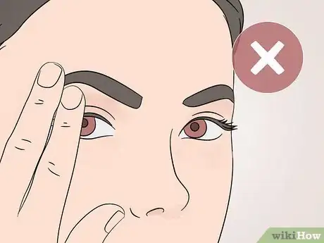 Image titled Stop Eyelids from Getting Oily Step 7