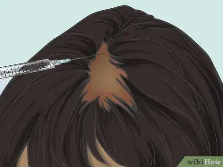 Image titled Grow Hair Back After a Scalp Fungal Infection Step 7