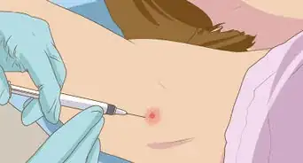 Get Rid of a Zit on Your Armpit