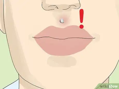 Image titled Get a Medusa Piercing Step 18