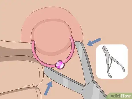 Image titled Remove a Nipple Piercing Step 16