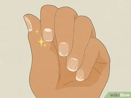 Image titled Stop Biting Your Nails Step 20