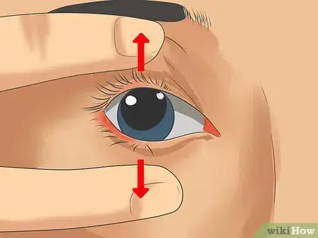 Image titled Use Contact Lenses Step 14