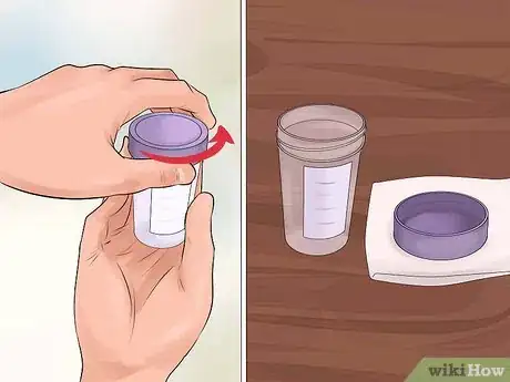 Image titled Help a Male Child Provide a Urine Sample Step 9