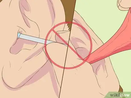 Image titled Use Ear Candles Step 23