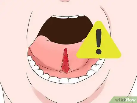 Image titled Get a Longer Tongue Step 7