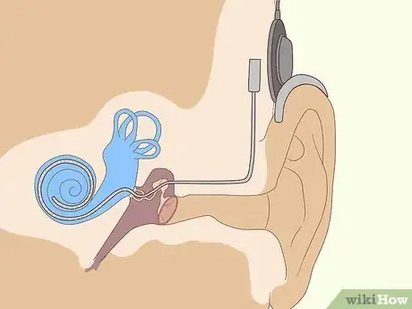 Image titled Improve Your Hearing Step 4