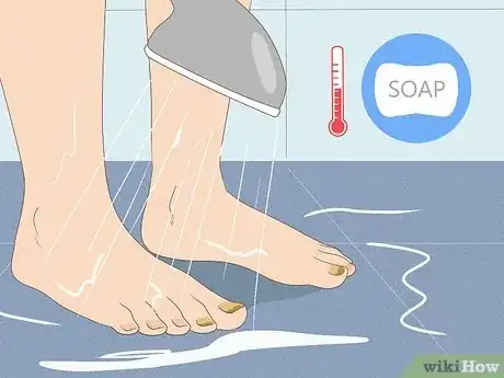 Image titled Get Rid of Yellow Toenails Step 1