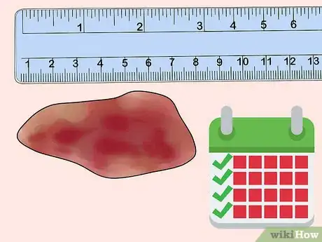 Image titled Measure Wounds Step 13