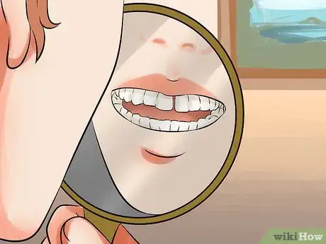 Image titled Get Rid of Gaps in Teeth Step 2