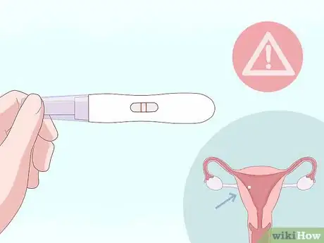 Image titled Identify Abnormal Vaginal Spotting Between Periods Step 8