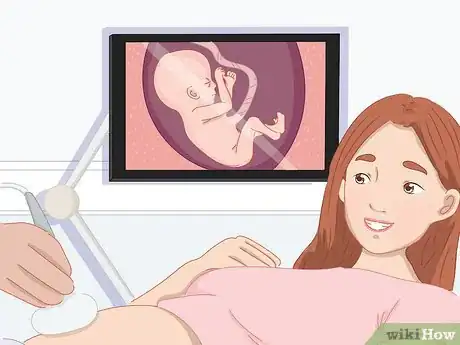 Image titled Tell a Baby's Gender from an Ultrasound Step 4