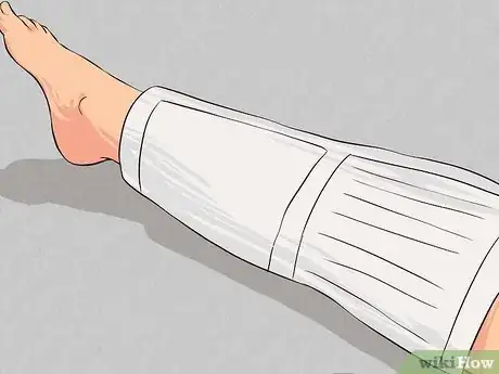 Image titled Apply First Aid without Bandages Step 19