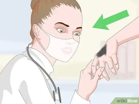 Image titled Remove Tar From Skin Step 16