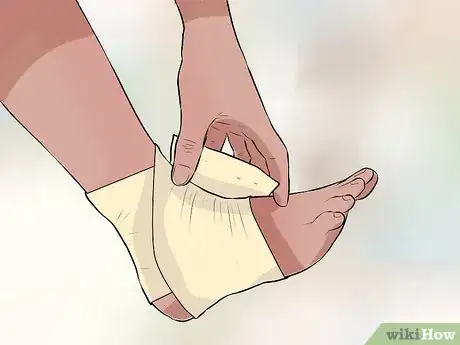 Image titled Treat a Sprain During First Aid Step 4