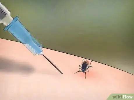 Image titled Remove a Deer Tick Step 15