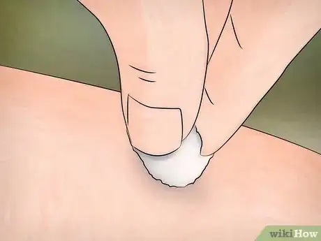 Image titled Remove a Deer Tick Step 2