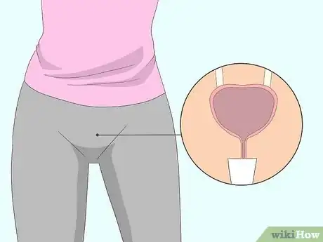 Image titled Do Kegel Exercises Step 4