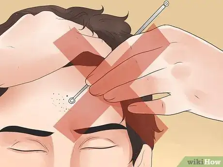 Image titled Remove Blackheads Step 20