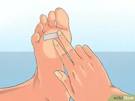 Image titled Get Rid of Plantar Warts (Verrucas) Step 4