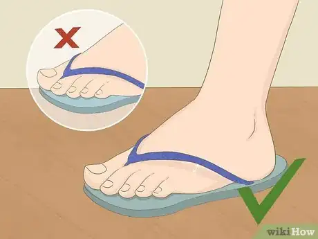 Image titled Buy and Walk in Flip Flops Step 2