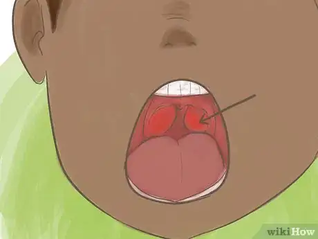 Image titled Teach Your Child to Chew with Her Mouth Closed Step 10