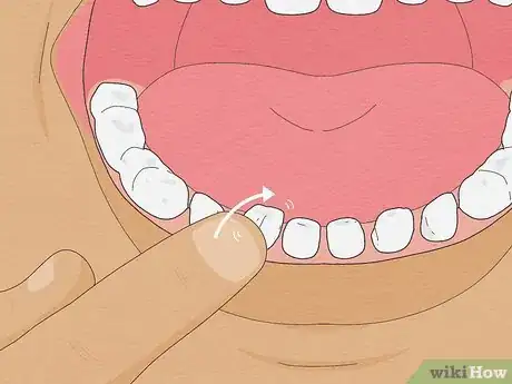 Image titled Pull a Loose Tooth at Home Step 1